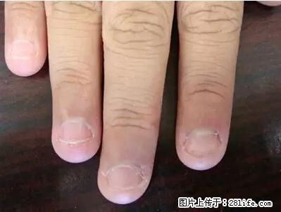 剪指甲、挖耳屎，这些日常小动作竟隐藏大危害！ - 潜江生活资讯 - 潜江28生活网 qianjiang.28life.net